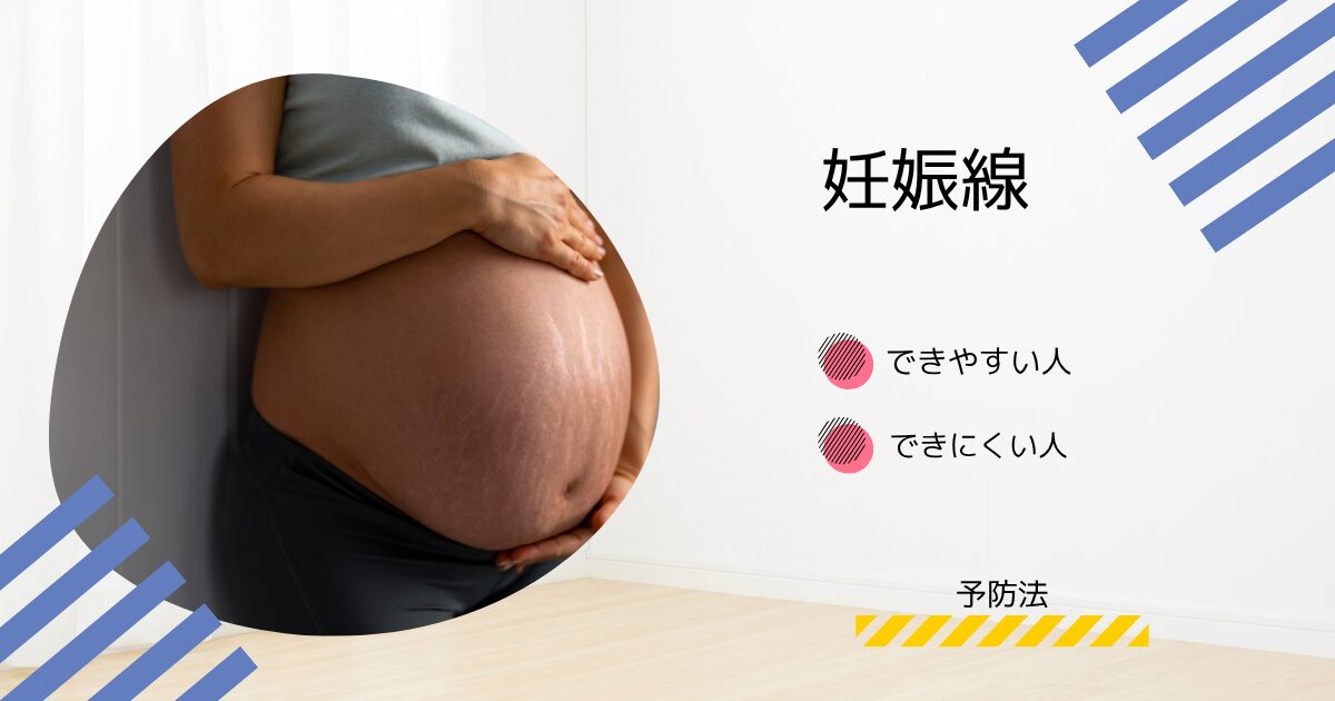 妊娠線　できやすい人　できにくい人　特徴　予防法